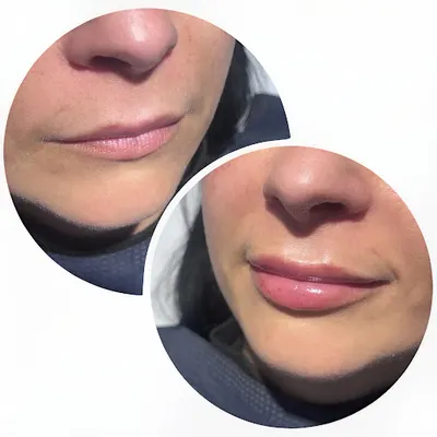 Medycyna estetyczna "Es Estetic Studio" Ewa Sak